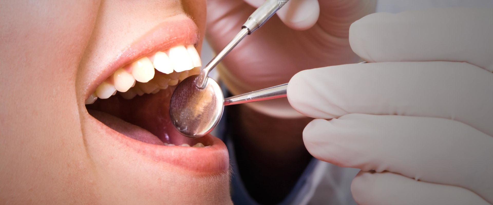 The Benefits of Regular Dental Checkups and Cleanings