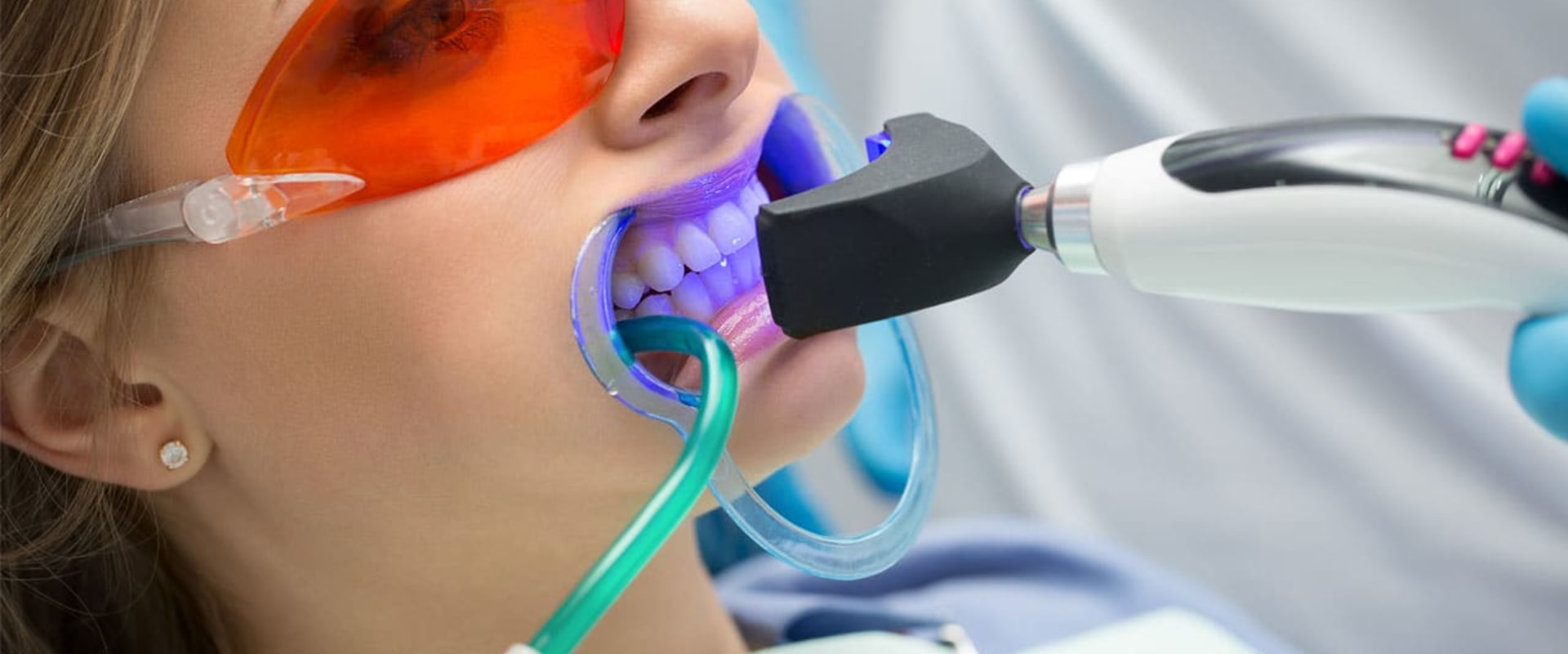 In-Office Teeth Whitening Treatments: What You Need to Know