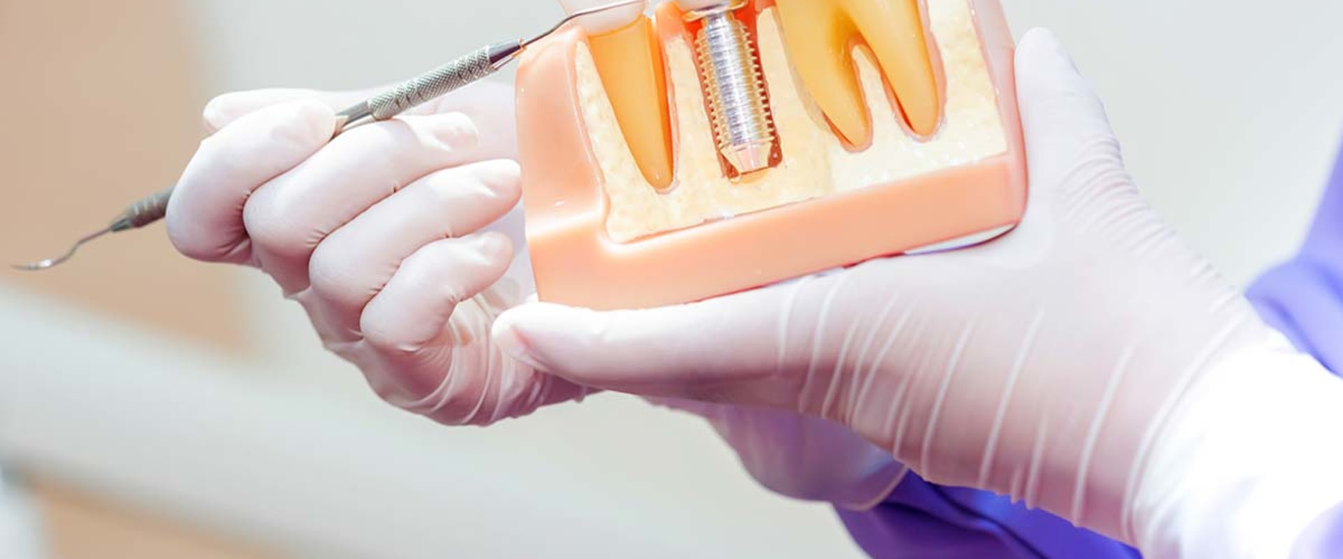 The Basics of Endosteal Implants