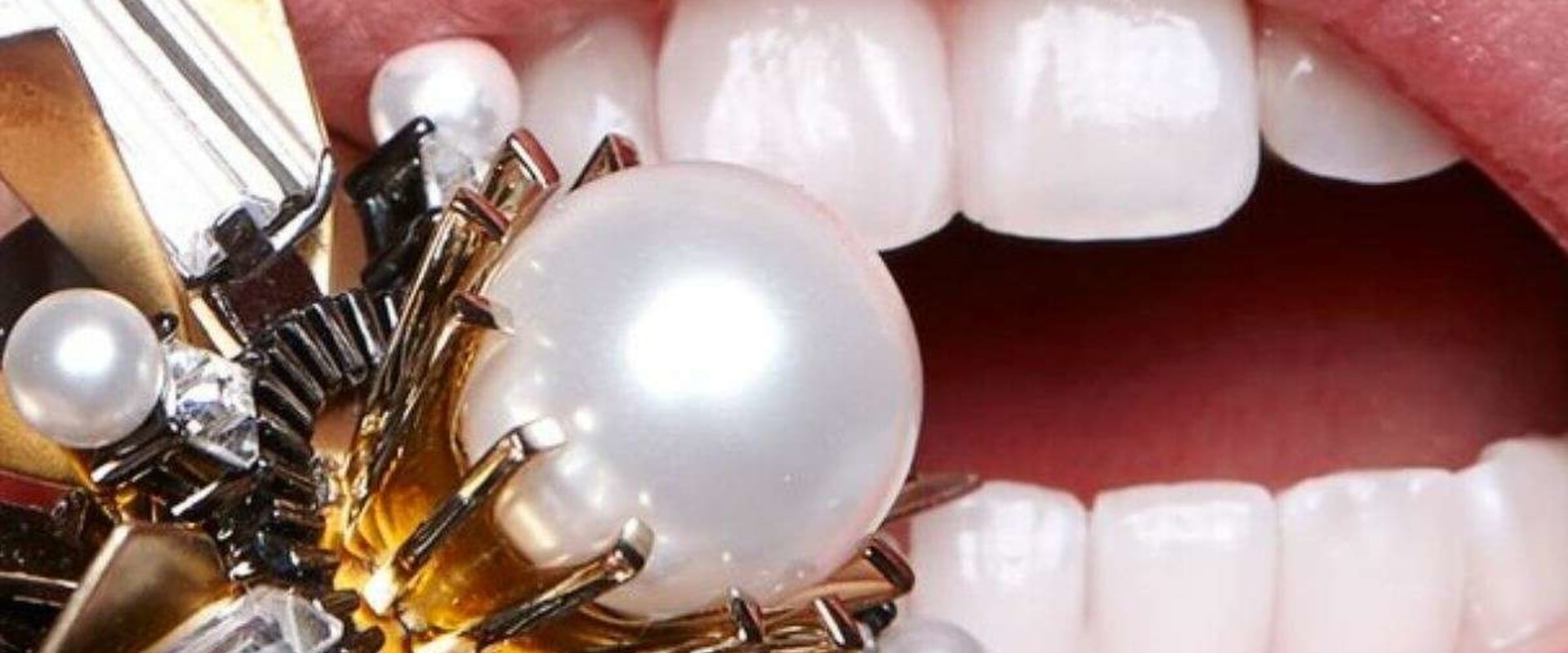 Tooth Bleaching Kits: An In-Depth Look