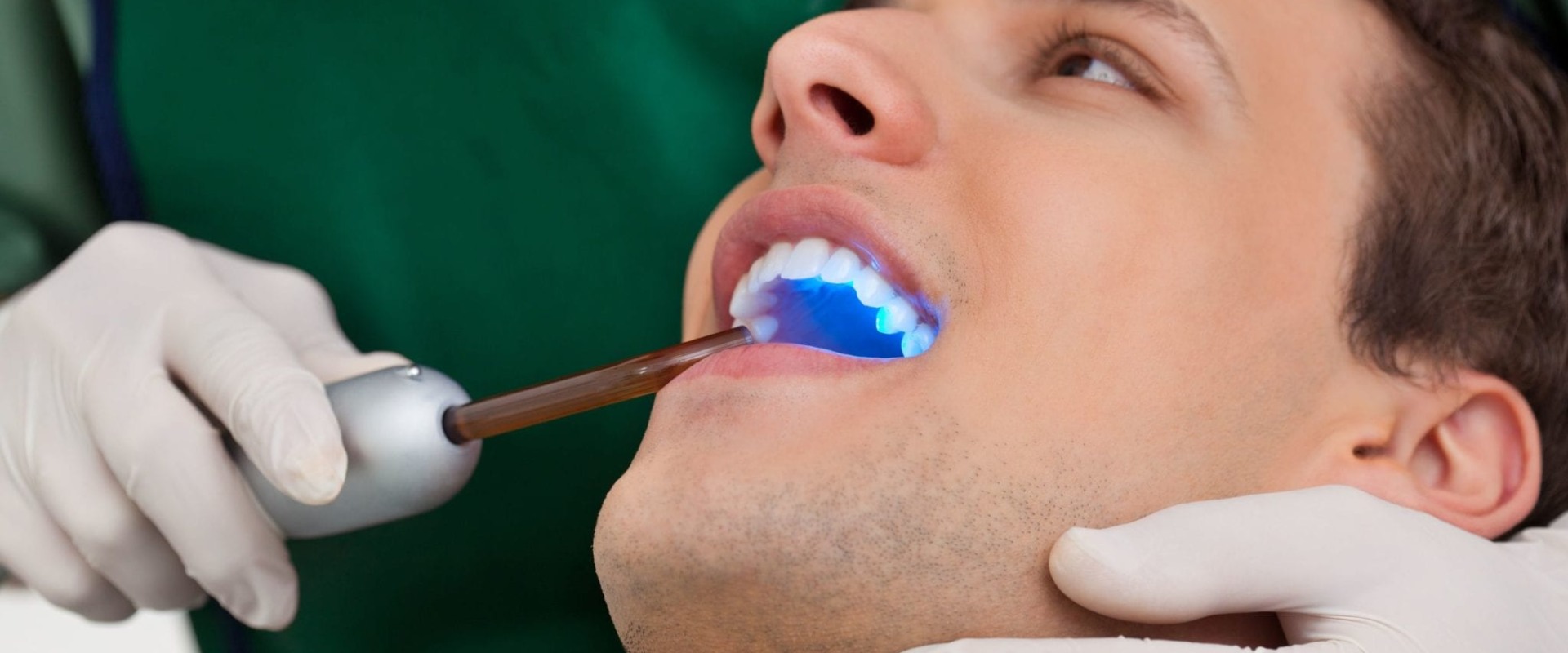 Everything You Need to Know about Sealants