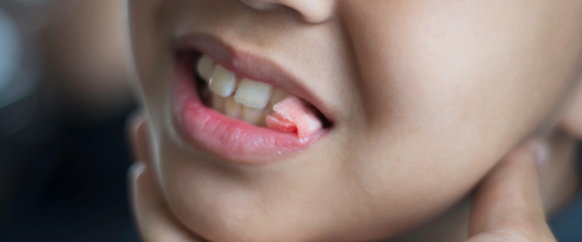 Caring for a Wound After an Extraction: A Guide