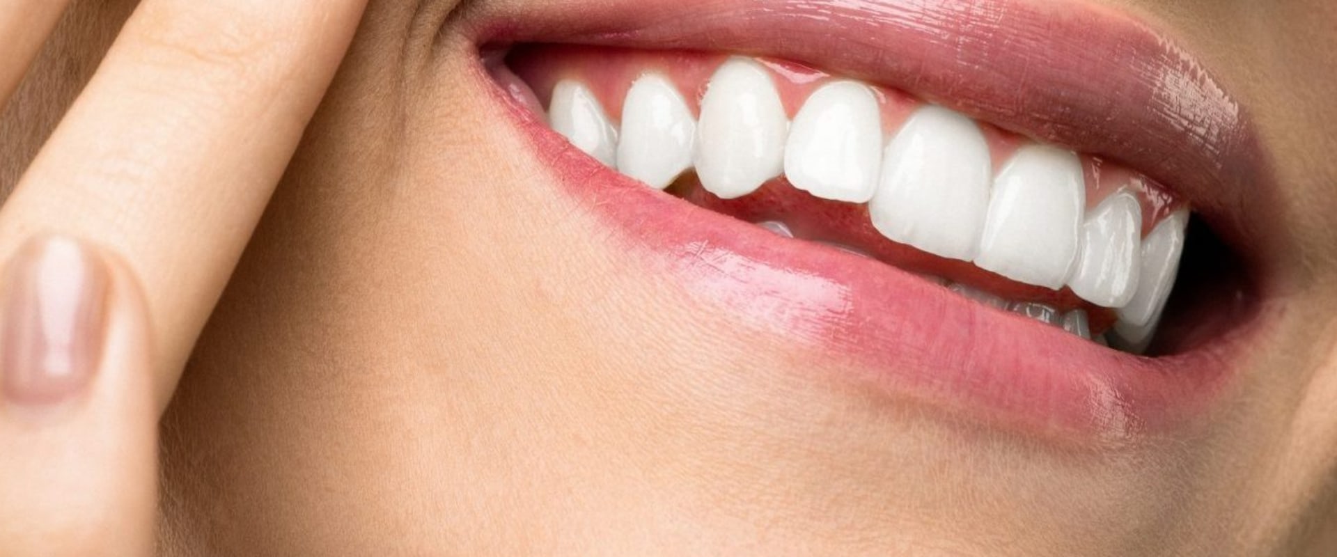 Teeth Whitening: Everything You Need to Know
