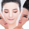 Whitening Products Explained: What You Need to Know