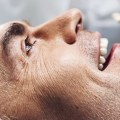 Removing the Infected Pulp: A Comprehensive Overview