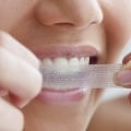 Whitening Strips and Gels Kits - Everything You Need to Know