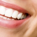 Gum Surgery: What You Need to Know