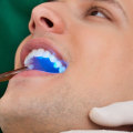 Everything You Need to Know about Sealants