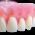 Everything You Need to Know About Dentures and Partial Dentures
