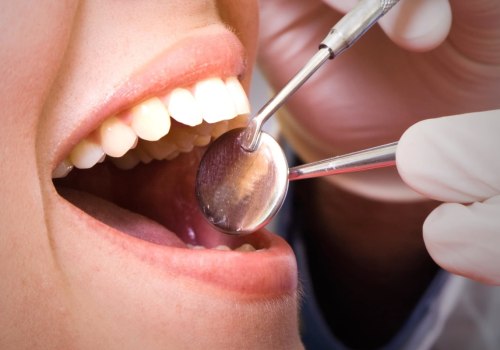 The Benefits of Regular Dental Checkups and Cleanings