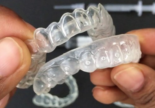 Whitening Trays With Bleaching Gel: Everything You Need to Know