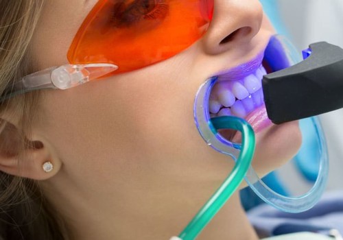 In-Office Teeth Whitening Treatments: What You Need to Know