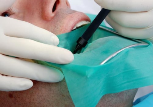 Caring for the Wound After a Root Canal Treatment