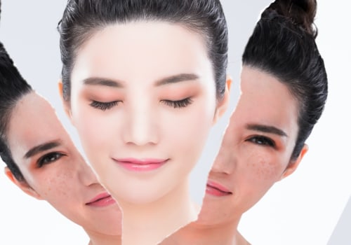 Whitening Products Explained: What You Need to Know