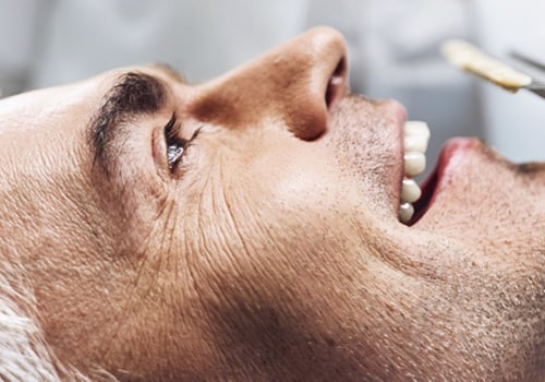 Removing the Infected Pulp: A Comprehensive Overview