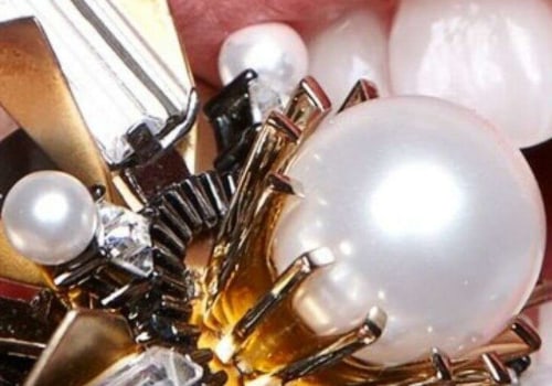Tooth Bleaching Kits: An In-Depth Look