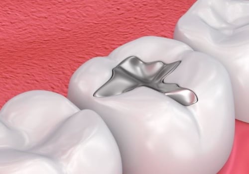 Filling the Inside of the Tooth