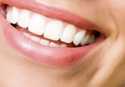 Gum Surgery: What You Need to Know
