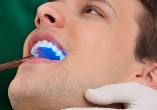 Everything You Need to Know about Sealants