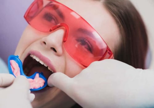 The Benefits of Fluoride Treatments for Dental Care